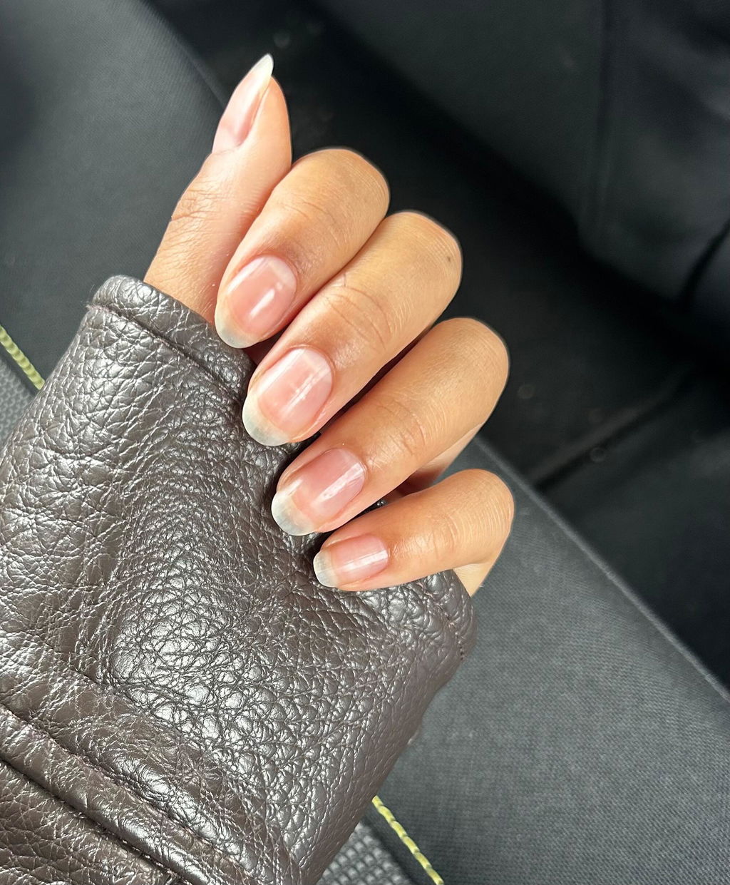 Rettet meine Nagelhaut