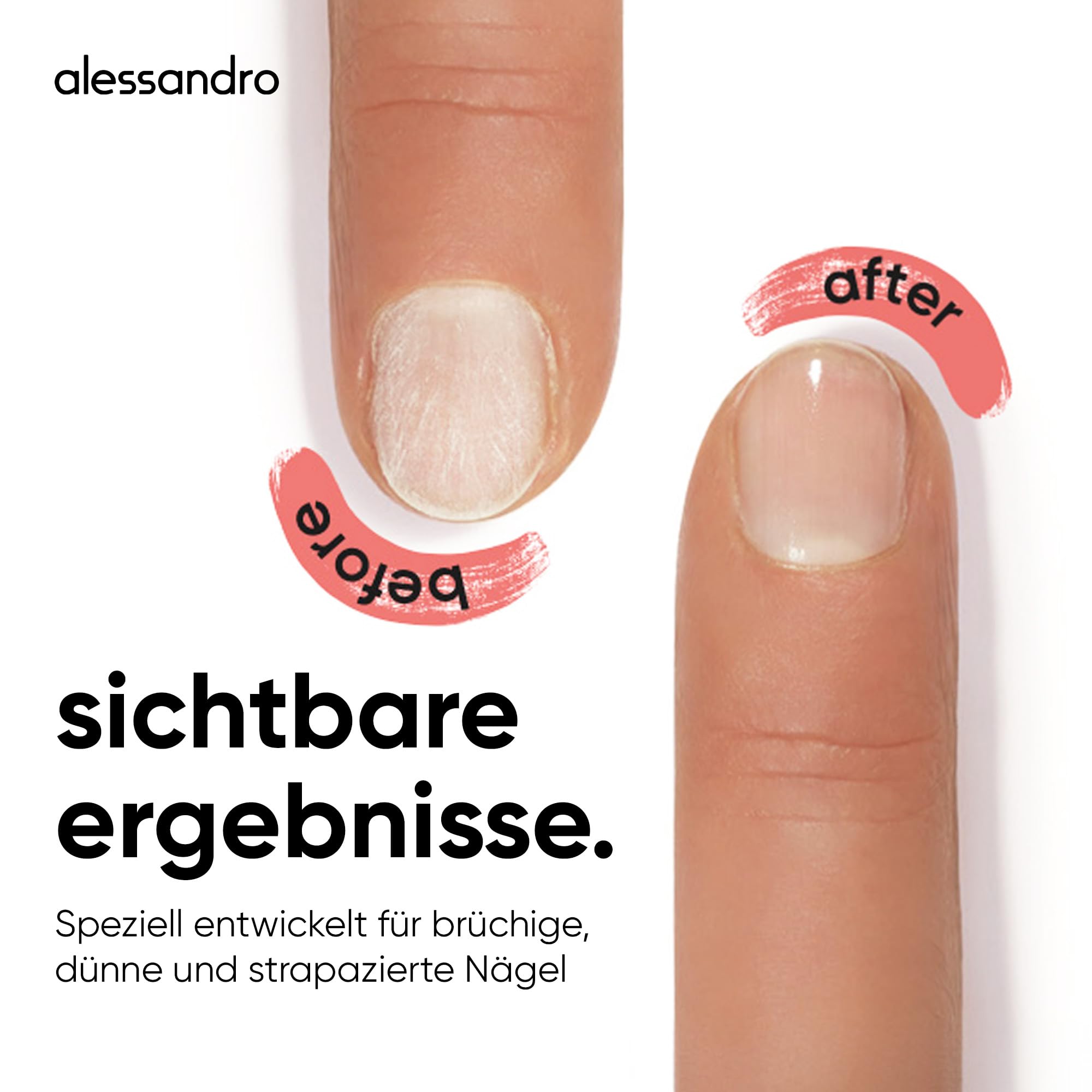 alessandro-sos-nail-repair-serum-nagelserum-10-ml image 4
