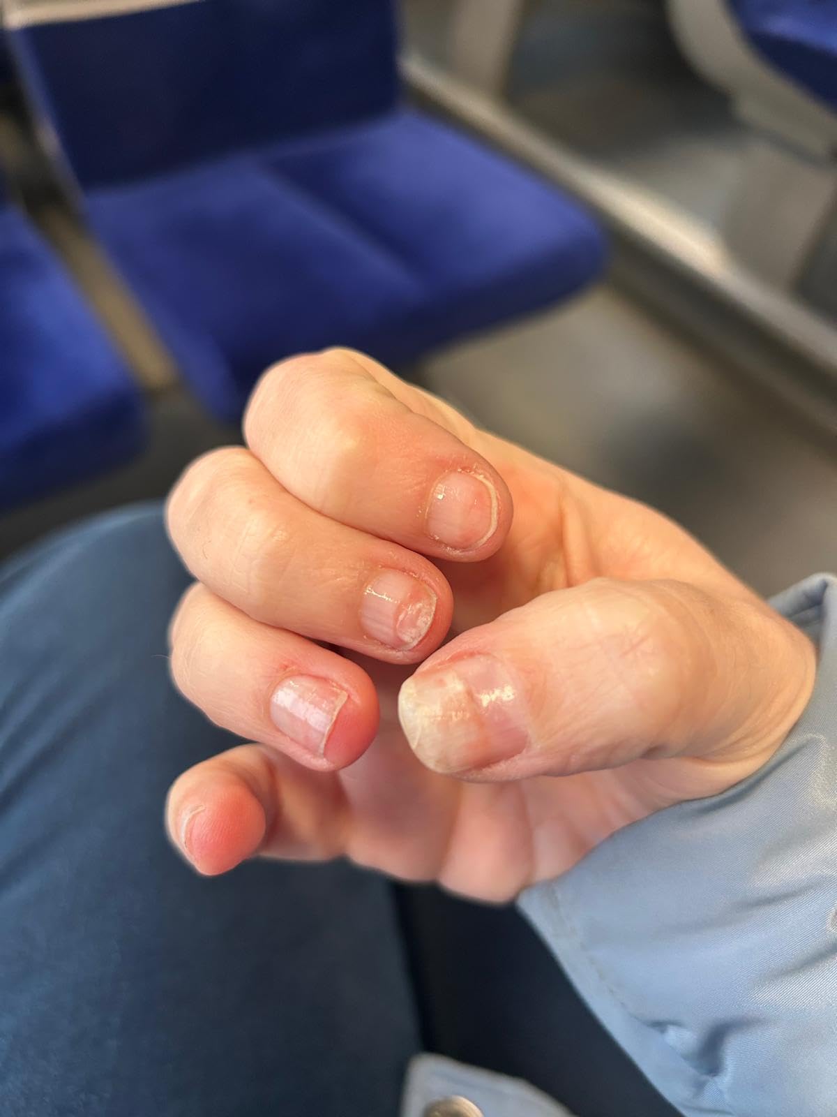 Nägel endlich nicht mehr brüchig